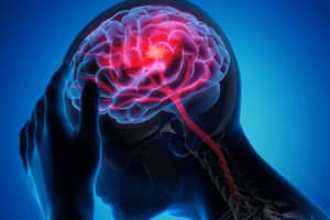Neurological issues https://mlkbnllevxvt.i.optimole.com/cb:ymBr.2164c/w:300/h:200/q:mauto/f:best/https://health-connect.co.in/wp-content/uploads/2023/10/Neurological-issues.jpg